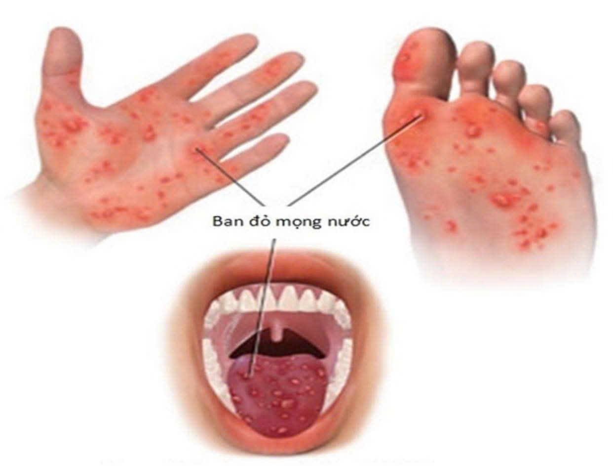 z7720648949739_44972d2a6a10c6073dc3f4151c509b64